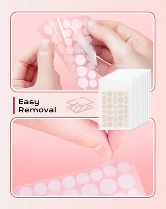 Invisible Pimple Patch - Hydrocolloid Plaster Waterproof & Breathable, Strong Absorption, Residue-Free, Acne Treatment (10 mm & 12 mm, 360 Pimple Patches)