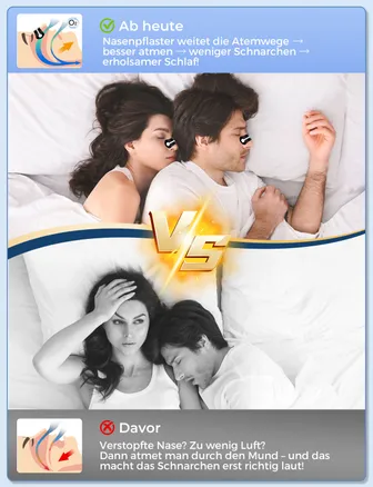 Nose Plasters Snoring Pack of 30 Snoring Stoppers, Reinforced Support Expands Nose Passages, Nose Strips Relieves Constipation, Improves Sleep, Anti Snoring