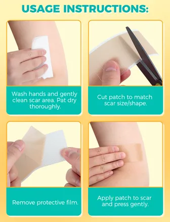 Silicone Scar Plaster, 150 cm, Reusable & Medical, for Caesarean Section, Scars & Keloid, Skin-friendly, Breathable, Waterproof