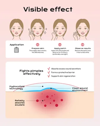 Invisible Pimple Patch - Hydrocolloid Plaster Waterproof & Breathable, Strong Absorption, Residue-Free, Acne Treatment (10 mm & 12 mm, 360 Pimple Patches)